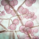 Subcategoría Candidiasis