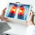 Subcategoría Infecciones respiratorias